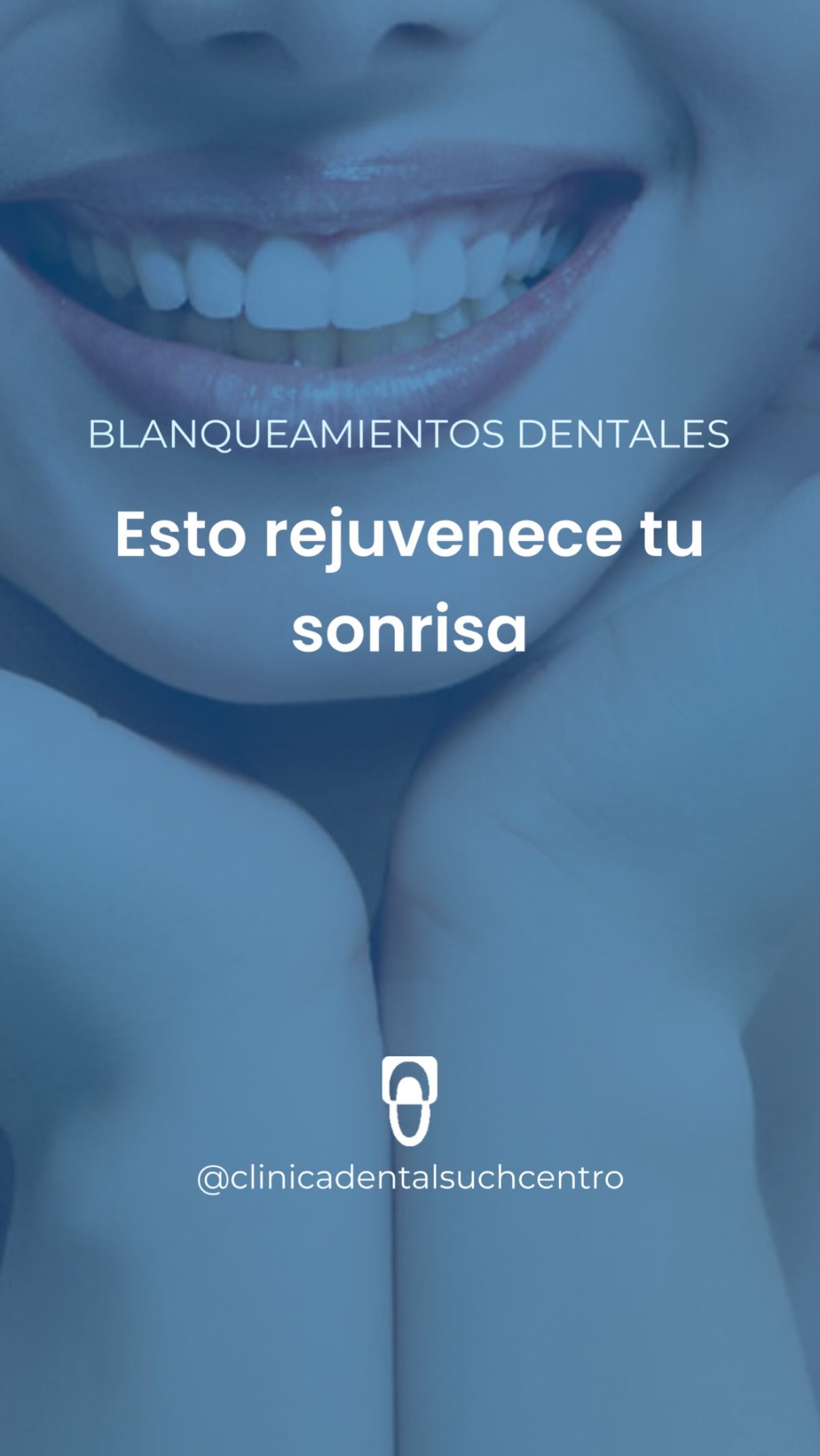 Periodoncia 66 Blanqueamiento dental
·
#dentistavalencia #dentistavalenciacentro #clinicadental